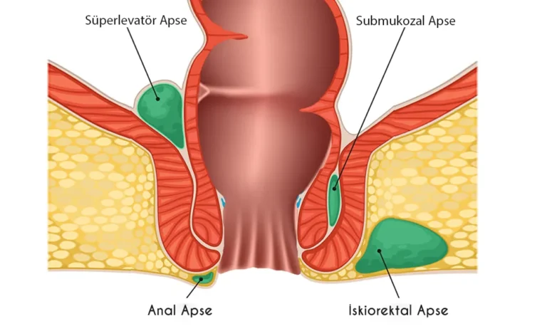 Anal Apse